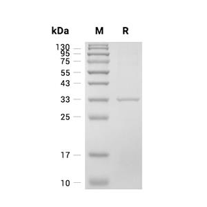 Carbonic Anhydrase 4蛋白, Human (HEK293, His),Carbonic Anhydrase 4 Protein, Human (HEK293, His)