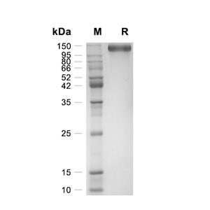 CD21蛋白, Human (HEK293, His),CD21 Protein, Human (HEK293, His)