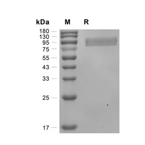 CSF1R蛋白, Mouse (HEK293, His),CSF1R Protein, Mouse (HEK293, His)