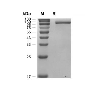 EphB2蛋白, Human (HEK293, His-Fc)