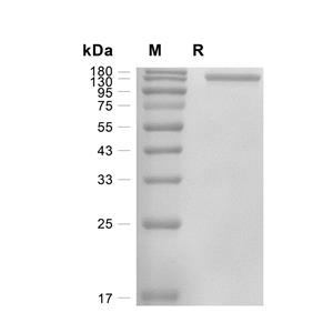 HER4蛋白, Human (HEK293, His-Fc),HER4 Protein, Human (HEK293, His-Fc)
