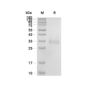 FGF-18蛋白, Human (HEK293, His)
