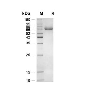 IL-12 beta蛋白, Human (HEK293, Fc),IL-12 beta Protein, Human (HEK293, Fc)