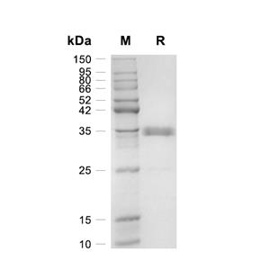 T-PA蛋白, Human (HEK293)