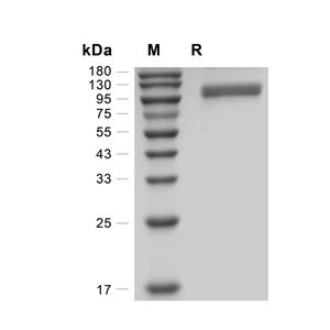 ACE2蛋白, Human (HEK293, His),ACE2 Protein, Human (HEK293, His)