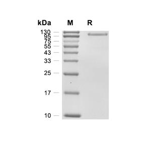 Serpin G1蛋白, Human (HEK293, His)