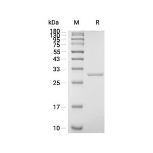 Carbonic Anhydrase 2蛋白, Human (C-His, Solution)