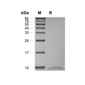 CD9蛋白, Human (HEK293, His)