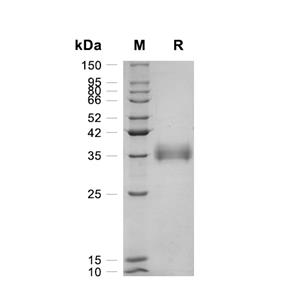 PD-L1蛋白, Human (HEK293)