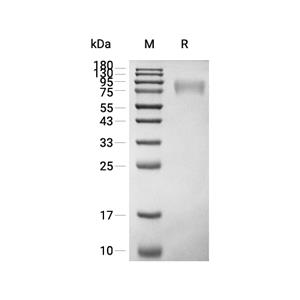 TrkB蛋白, Rat (HEK293, His, solution)