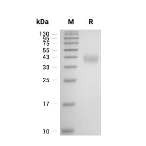 CD84/SLAMF5蛋白, Mouse (HEK293, His, solution)