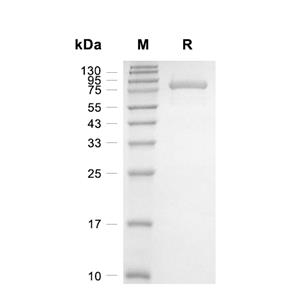 Lck蛋白, Human (sf9, GST)