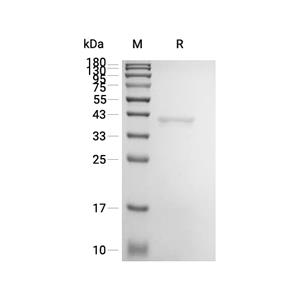 LOK蛋白, Human (His)