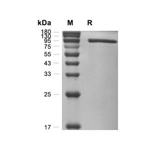 MMP-9蛋白, Rat (HEK293, His)