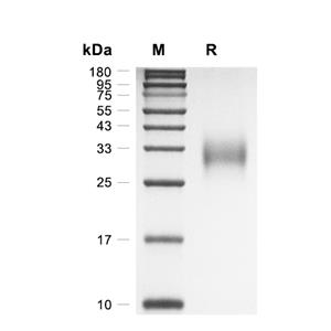 PD-1蛋白, Rat (HEK293, His)