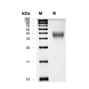 PD-1蛋白, Rhesus Macaque (HEK293, His),PD-1 Protein, Rhesus Macaque (HEK293, His)