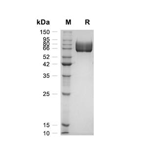 PD-L1蛋白, Rat (HEK293, Fc)