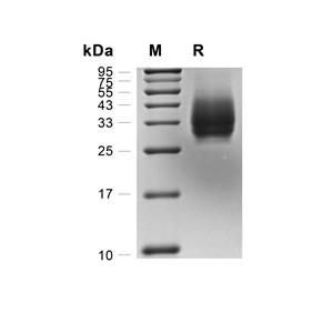 PD-L2蛋白, Rat (HEK293, His)