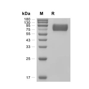 TrkA蛋白, Rat (HEK293, His)