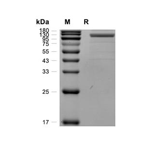 Siglec-10蛋白, Human (HEK293, Fc),Siglec-10 Protein, Human (HEK293, Fc)