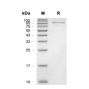 STAT1蛋白, Human (sf9, His-GST)