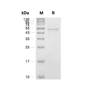 GSK-3 beta蛋白, Mouse (sf9, His)