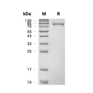 YES1蛋白, Human (sf9, His-GST),YES1 Protein, Human (sf9, His-GST)