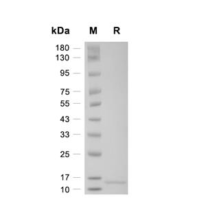 Cystatin C/CST3蛋白, Human (HEK293)