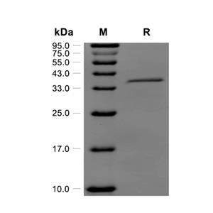 Resistin蛋白, Mouse (HEK293, Fc)