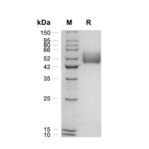 IL-1R1蛋白, Human (HEK293, His)