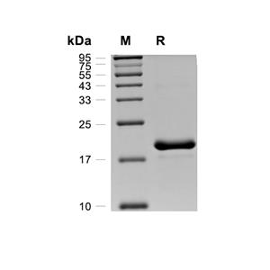 IFN-alpha 13/IFNA13蛋白, Cynomolgus (HEK293, His)