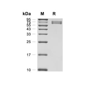 TRP1蛋白, Human (HEK293, His)