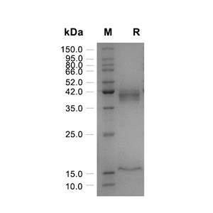 Activin A蛋白, Human/Mouse/Rat (HEK293, His),Activin A Protein, Human/Mouse/Rat (HEK293, His)