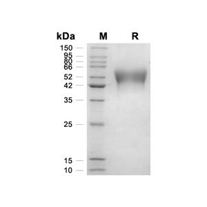 IL-6R alpha蛋白, Mouse (HEK293, His)