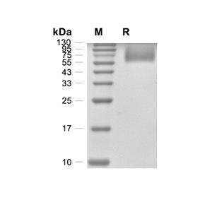 SIRP alpha/CD172a蛋白, Mouse (HEK293, His)