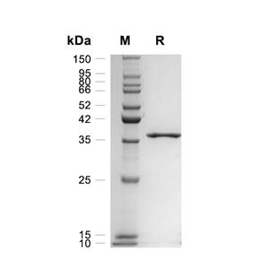 Ki67/MKI67蛋白, Human (GST)