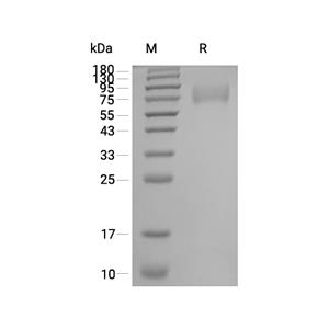 SCARB2/LIMP-2蛋白, Mouse (HEK293, His)