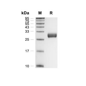Ephrin B3蛋白, Rat (HEK293, His)