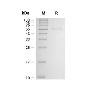 IFN-beta蛋白, Rhesus Macaque (HEK293, Fc)