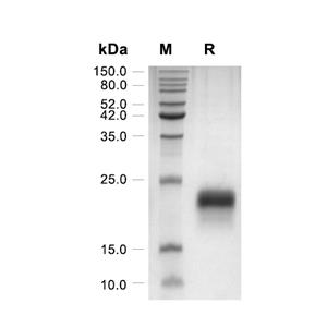 VEGF-C蛋白, Mouse/Rat (HEK293, His)