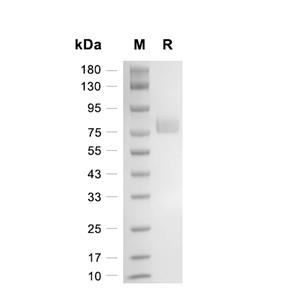 PD-L1蛋白, Mouse (HEK293, His-Fc)