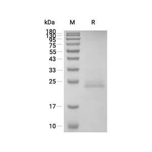 IFN-alpha 1/IFNA1蛋白, Mouse (P.pastoris, His)