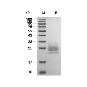 M-CSF蛋白, Human (HEK293, His)