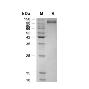 E-Selectin/CD62E蛋白, Human (HEK293, His-Fc)