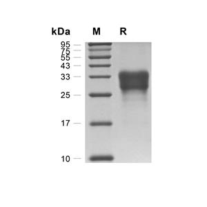 CD8 alpha蛋白, Mouse (HEK293, His)