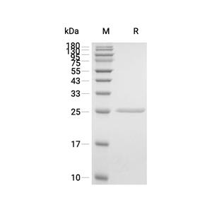 C-Reactive蛋白, Human (HEK293, solution),C-Reactive Protein, Human (HEK293, solution)