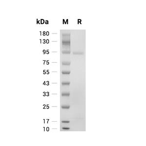 PCSK9蛋白, Human (HEK293, mFc)