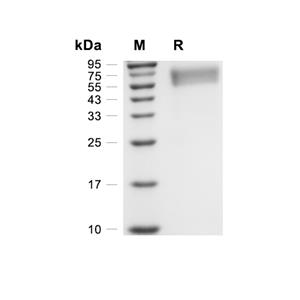 IL-1R1蛋白, Rat (HEK293, His)