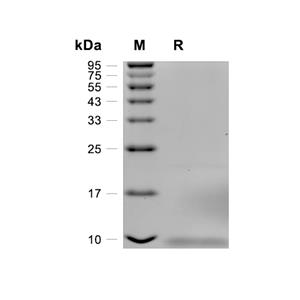 CD81蛋白, Human (HEK293, His),CD81 Protein, Human (HEK293, His)