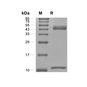CD1D-B2M Heterodimer蛋白, Human (HEK293, His)